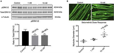 The MEK-Inhibitor Selumetinib Attenuates Tumor Growth and Reduces IL-6 Expression but Does Not Protect against Muscle Wasting in Lewis Lung Cancer Cachexia